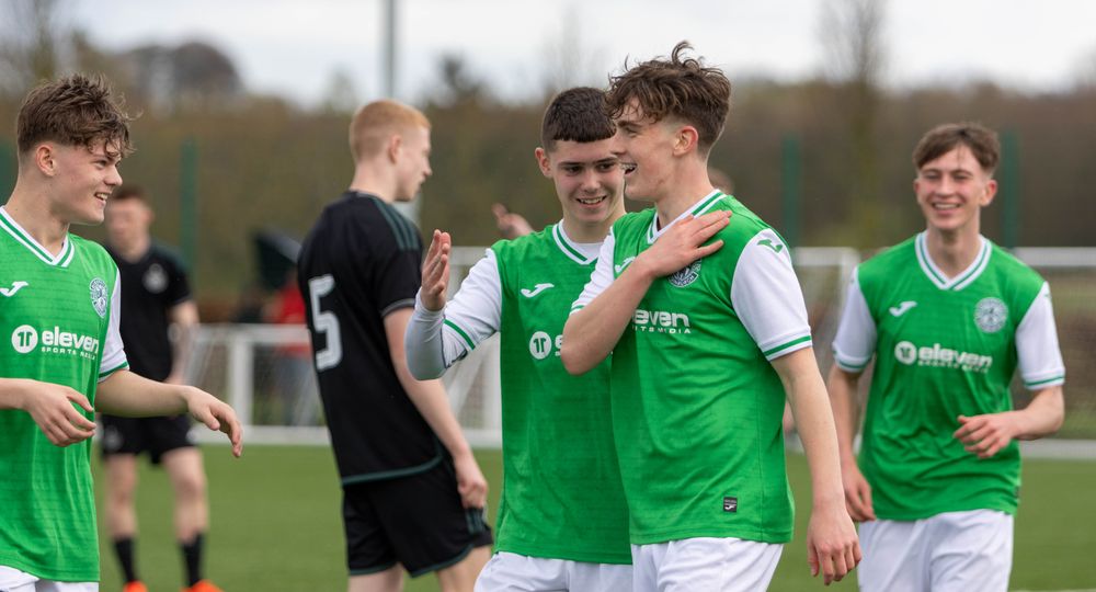 Hibernian FC | Report: Hibs U18s 4-1 Celtic