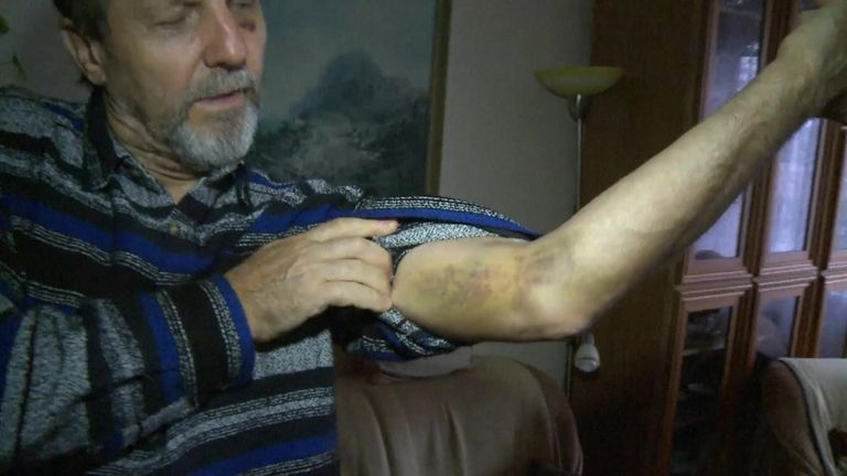 Juraj Cintula was beaten while working as a security guard.
Pic: ENEX