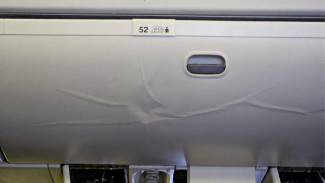 This photo shows a large dent in an overhead bin on a Singapore Airlines flight that encountered severe turbulence on Monday, May 20, 2024.