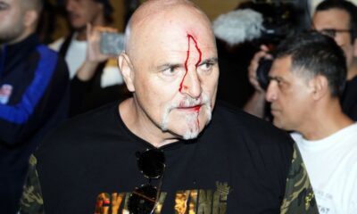 John Fury left bloodied after headbutting Oleksandr Usyk team member