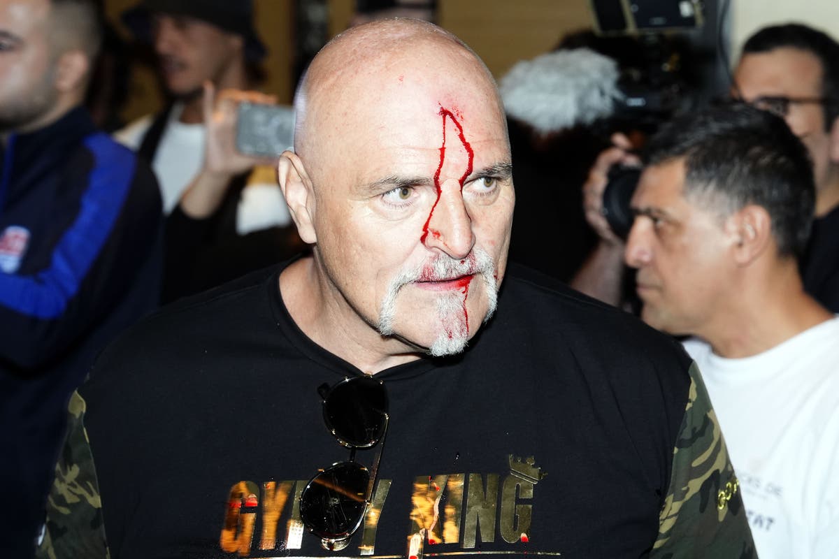 John Fury left bloodied after headbutting Oleksandr Usyk team member