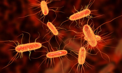 Food-linked E.Coli cases on the rise in UK