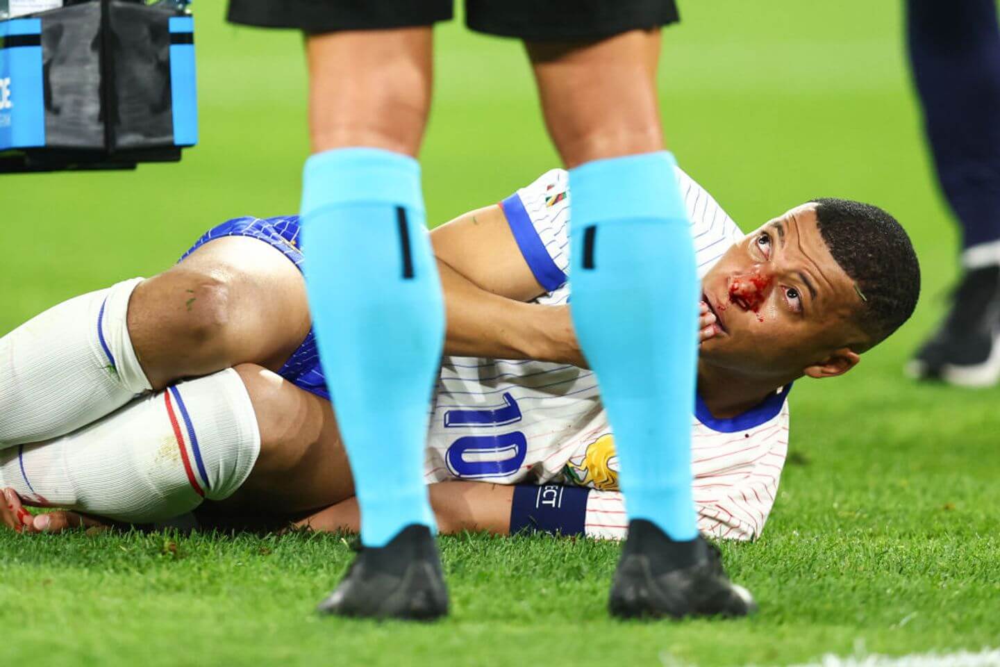 France vs Austria live updates: Kylian Mbappe nose injury sours 1-0 Euro 2024 win for Les Blues