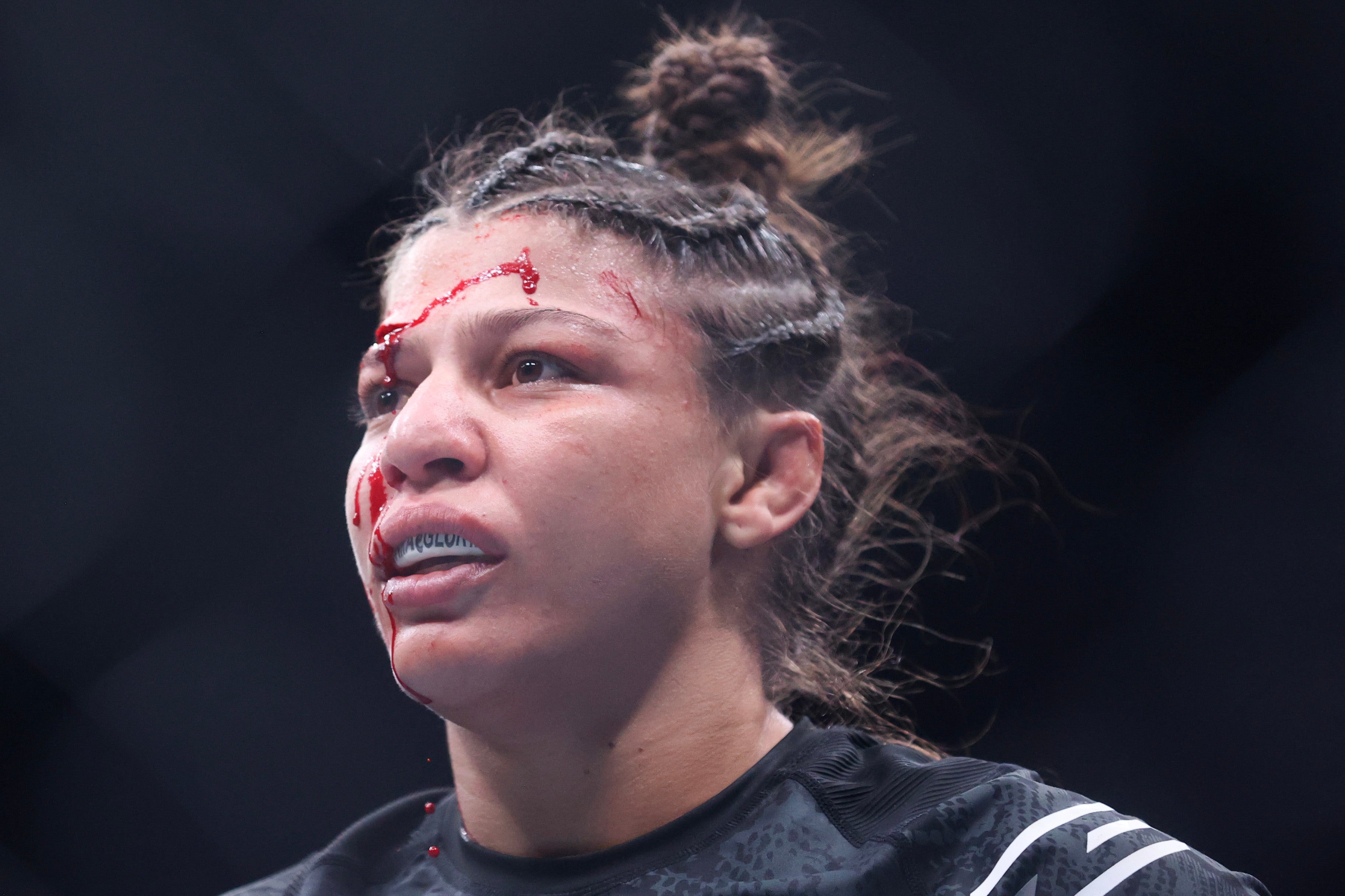 Bueno Silva’s cut forced her fight with Chiasson to be stopped