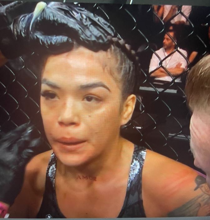 Cortez had just one eyelash for the rest of the fight