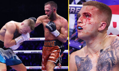 Campbell Hatton loses again as Ricky Hatton's son suffers horror cut and fails to get redemption over boxer who took his unbeaten record