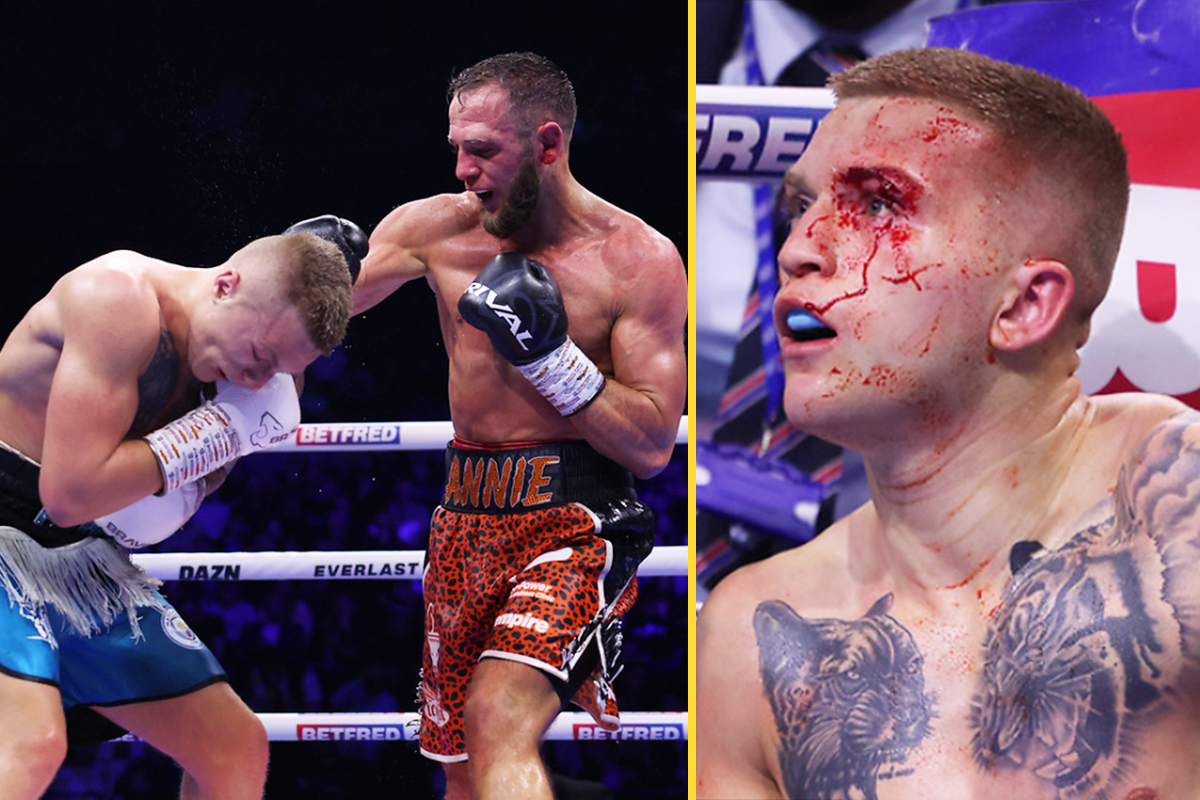 Campbell Hatton loses again as Ricky Hatton's son suffers horror cut and fails to get redemption over boxer who took his unbeaten record