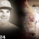 Pete Rose dies