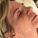 Zoe Ball’s illness: what is TMJ disorder and how is it treated?