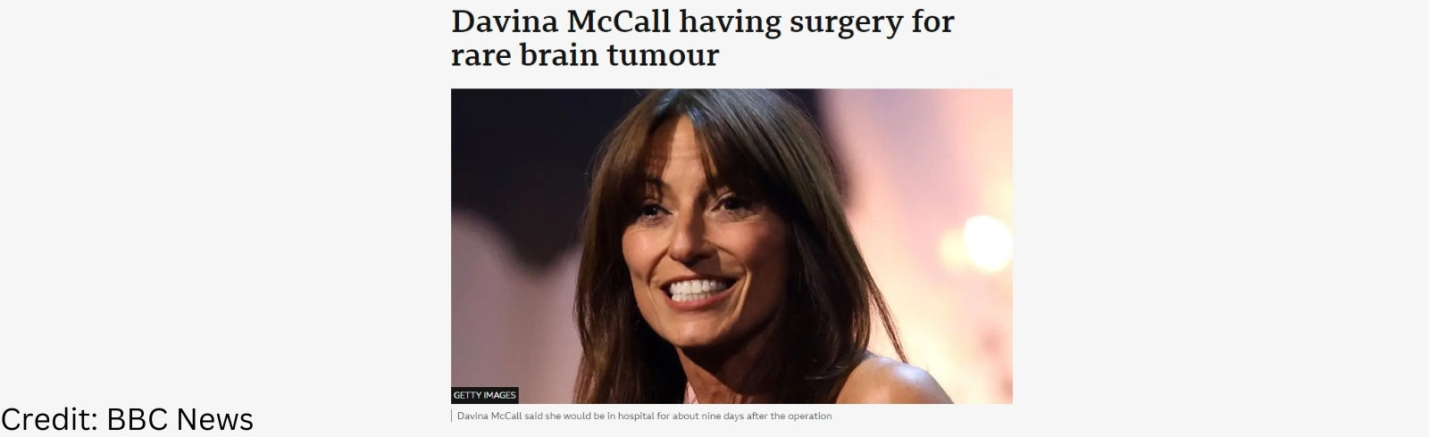 Davina McCall undergoes surgery for a brain tumour – Brain Tumour Research