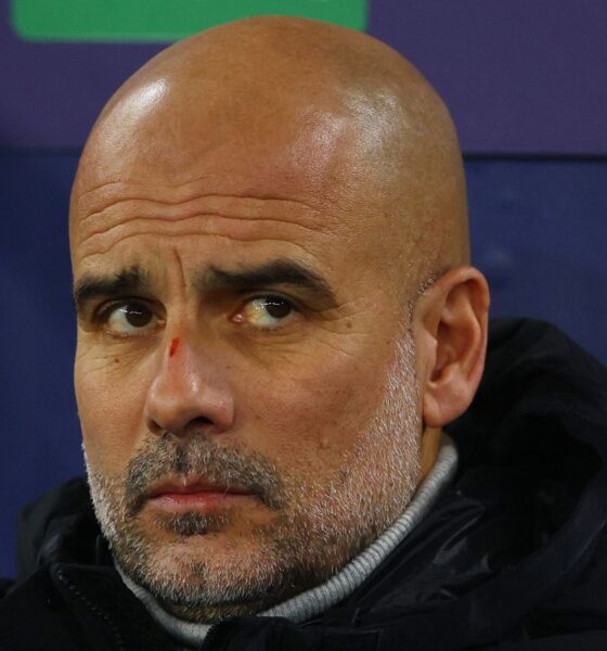 Pep Guardiola had a cut on his nose during the match. Pic: Reuters