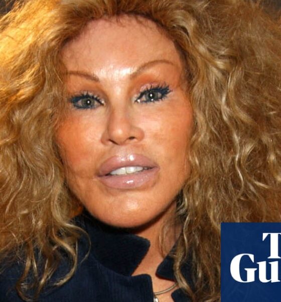 Jocelyne Wildenstein, socialite known for extreme cat-like plastic surgery, dies at 84 | Paris