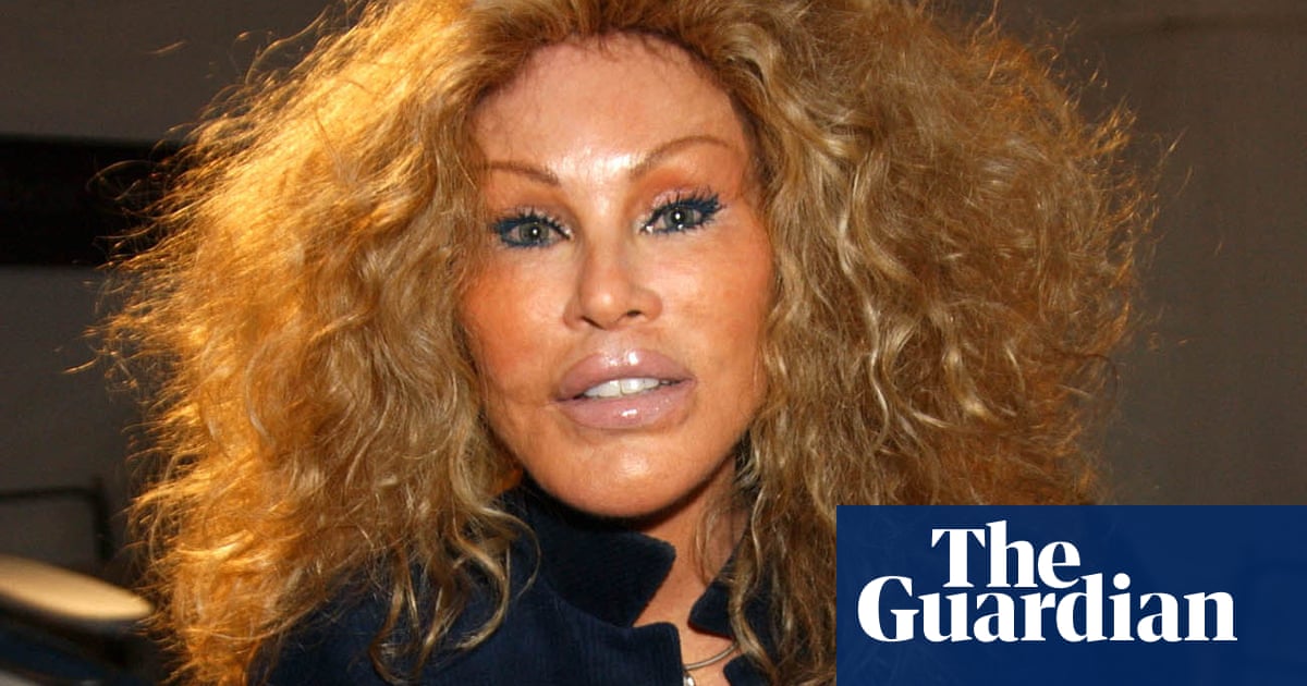 Jocelyne Wildenstein, socialite known for extreme cat-like plastic surgery, dies at 84 | Paris