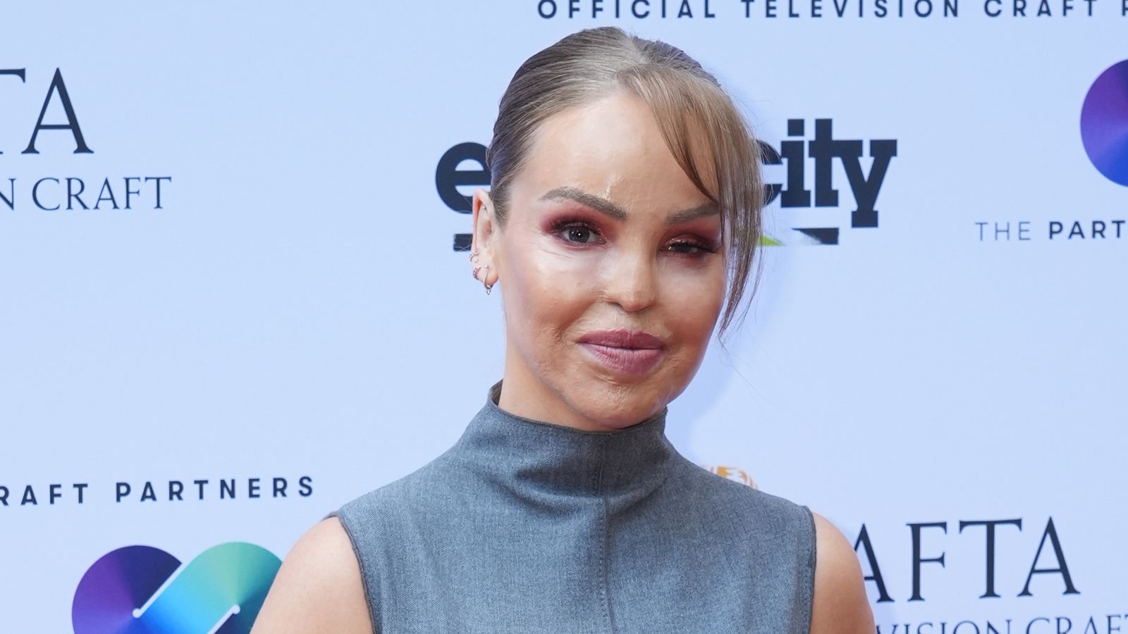 Katie Piper reveals artificial eye decision - 16 years after acid attack | Ents & Arts News