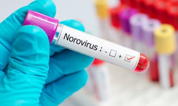 What is norovirus? What to know as stomach flu cases rise